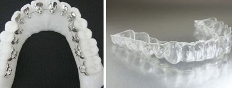 杭州有哪些紋身醫(yī)院排行榜，前三大發(fā)現(xiàn)！