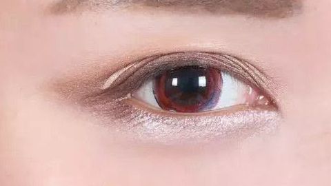 中南大學湘雅醫(yī)院眼袋整形揭秘：專家團隊、手術解析