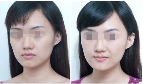 中山整形醫(yī)院八強名單公開！看看這些優(yōu)質(zhì)醫(yī)院是否入選受關(guān)注！