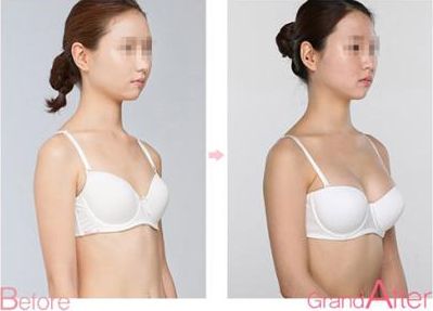 成都祛斑醫(yī)院排名前八，告訴你哪家靠譜