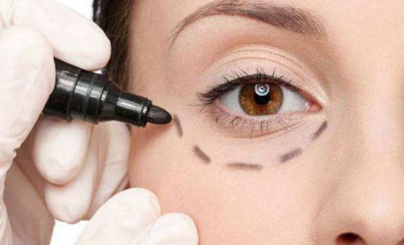 北京協(xié)和醫(yī)院面部提升價格及預(yù)約攻略一覽