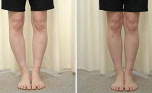 如何使用蜂蜜進行減肥？有效嗎？