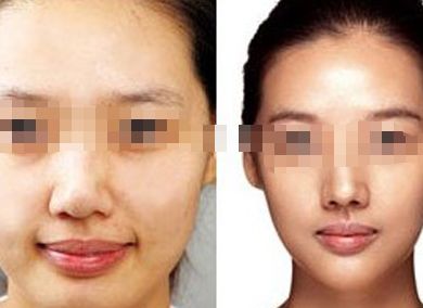 女星蠟像面容成災(zāi)，孫菲菲領(lǐng)銜瘦臉狂潮