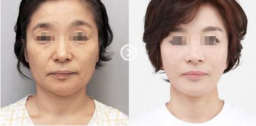 蘇州奧克拉醫(yī)院的整形效果及評價如何？