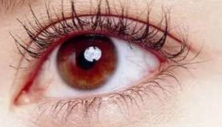 精雕明眸：深度評(píng)測(cè)雙眼皮醫(yī)院，自然恢復(fù)快？選這家就對(duì)了！