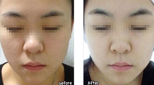 合肥哪些整形醫(yī)院名氣最大？