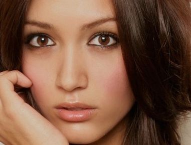 大慶超龍雙眼皮修復效果及全切修復凹陷解決方案