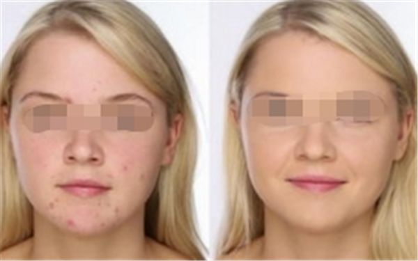 額頭飽滿與個(gè)人命運(yùn)：科學(xué)解讀面相學(xué)說(shuō)