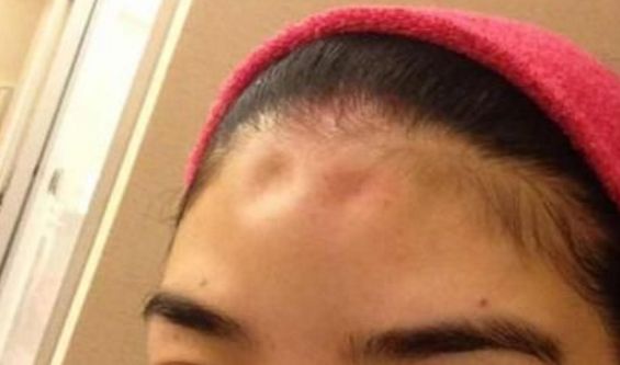 關(guān)于眼部整形醫(yī)院的最新動(dòng)態(tài)