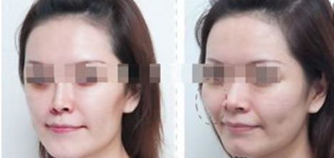 杭州整形美容醫(yī)院排名前六，你值得了解的每一家！