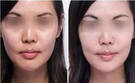 蚌埠最優(yōu)選！第一人民醫(yī)院整形科醫(yī)生名單公開，四月價格表持續(xù)更新！