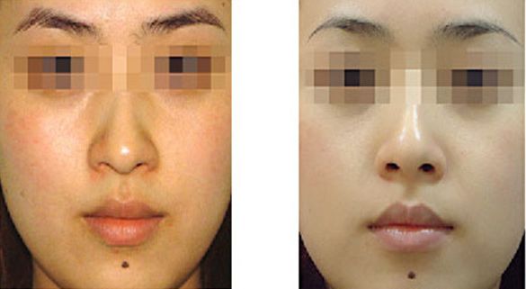 青島市城陽區(qū)吸脂整形醫(yī)院哪家好，用戶評價排名前三