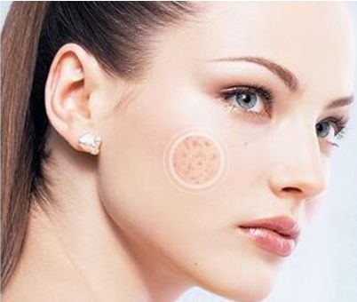 武漢漾顏醫(yī)療美容醫(yī)院：玻尿酸注射專(zhuān)家大揭秘！