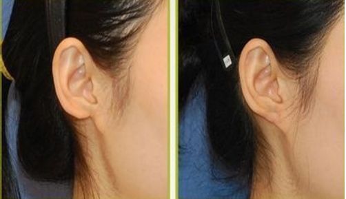 大慶拉皮手術(shù)好口碑醫(yī)院推薦：用戶真實評價分享！