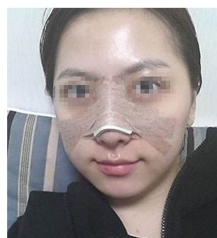 長(zhǎng)春哪家醫(yī)療機(jī)構(gòu)技術(shù)受認(rèn)可，雙眼皮整形實(shí)效較顯著