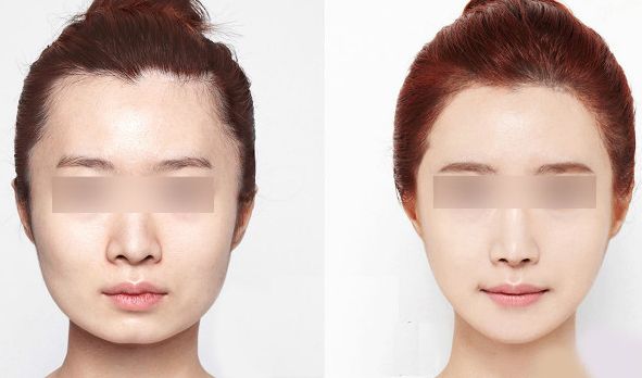 西安藝星醫(yī)療美容醫(yī)院2023年價格一覽：了解醫(yī)療美容服務(wù)費用信息，醫(yī)生簡介待查！