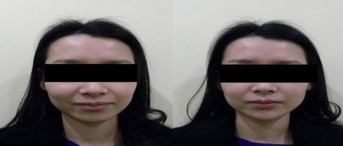 優(yōu)質(zhì)整形醫(yī)院排行榜，找哪家吸脂效果好？