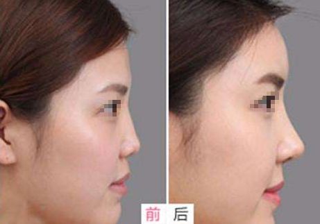 重慶小柯麗格口碑揭秘：權(quán)威機(jī)構(gòu)認(rèn)證，美麗蛻變首選