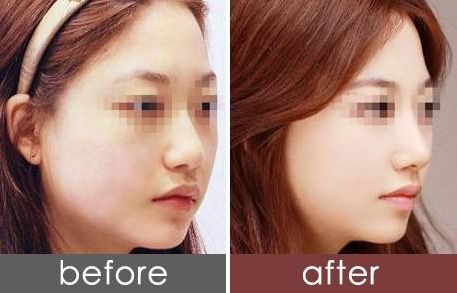 貴陽(yáng)美萊黃金元美膚三周年特惠：特價(jià)套餐￥8800元！