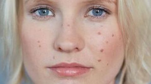 重慶中醫(yī)院整形科：專家推薦的優(yōu)秀項(xiàng)目及豐富醫(yī)院科室醫(yī)生信息！