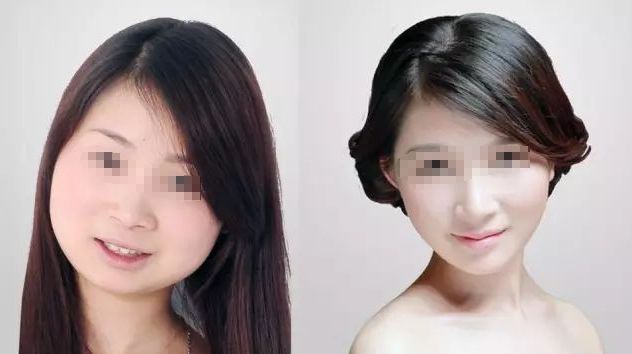 成都藝星何林：打造自然大方雙眼皮，3位顧客口碑爆棚