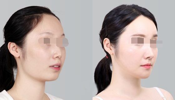 浙江整形外科醫(yī)院排行榜出爐，引領(lǐng)美麗新風(fēng)尚！