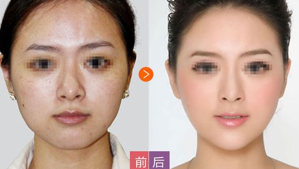 邢臺(tái)博愛高健整容致命嗎？高健整容水平值得信賴！