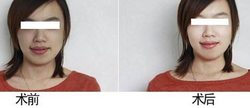 重慶時(shí)光整形美容醫(yī)院解析：專業(yè)實(shí)力口碑好，名醫(yī)薈萃信賴之選