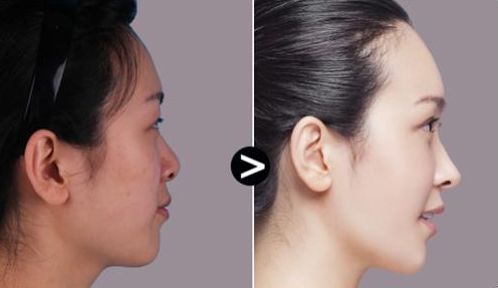 西安哪家整形醫(yī)院匯總排名前十？專業(yè)權(quán)威醫(yī)院推薦！