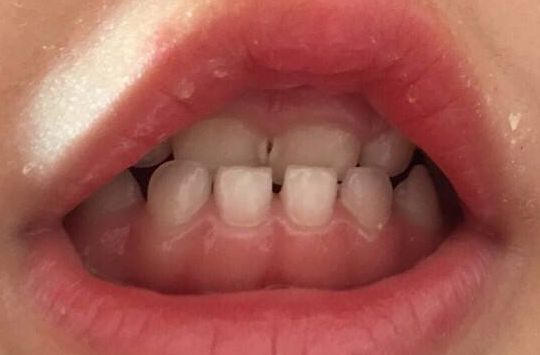 鄭州瑞顏會整形醫(yī)院，誠信專業(yè)值得信賴