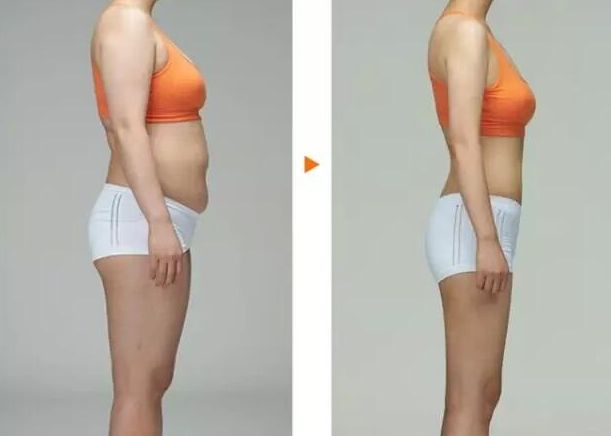 杭州頂尖整形醫(yī)院推薦，專家為您解析最佳醫(yī)院名單