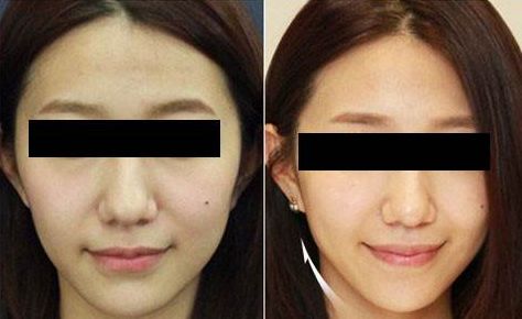 臨沂市哪家整形美容醫(yī)院口碑比較好？