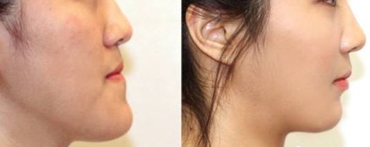 重慶軍科整形美容醫(yī)院口碑如何？醫(yī)生技術(shù)看評價，了解綜合實力！