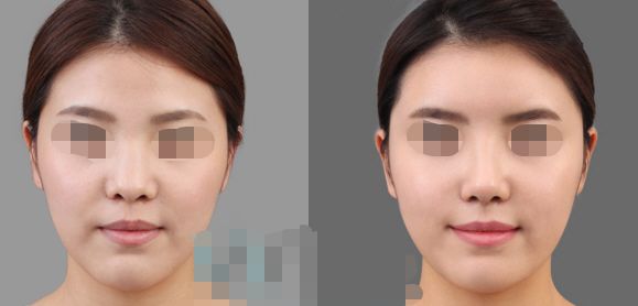 長春市更受歡迎的整形醫(yī)療機構揭曉