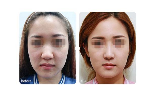 廣州優(yōu)質(zhì)磨骨整形醫(yī)院推薦！TOP10醫(yī)療機構(gòu)揭秘