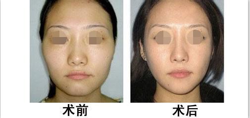 蘭州有哪些專業(yè)整形醫(yī)院值得去？