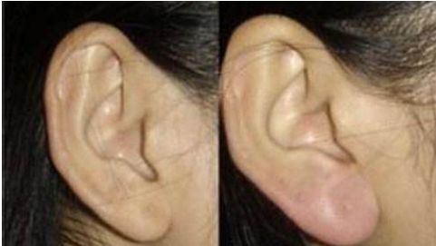 河南耳朵再造醫(yī)院排名榜單：鄭州南陽最佳耳部整形醫(yī)院盤點(diǎn)