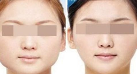 2024大連哪家醫(yī)院吸脂效果最好？這里有前十名匯總！