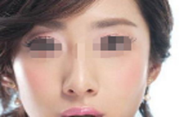 蘇州祛斑整形醫(yī)院哪家好？點(diǎn)擊查看排名前四家醫(yī)院名單！