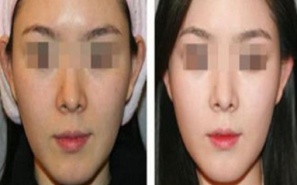 銅陵博愛醫(yī)院醫(yī)療美容科，專業(yè)醫(yī)生技術(shù)如何？