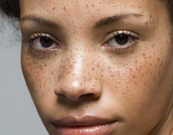 北京雙眼皮手術(shù)哪家醫(yī)院好？專業(yè)推薦前三名