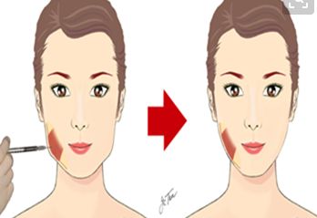 阜陽值得信賴的眼科醫(yī)院推薦與近視手術費用參考