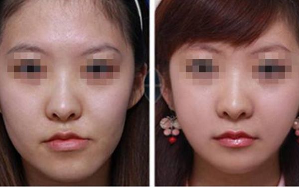 【2024】西安微整形醫(yī)院哪家好？排行榜大揭秘！