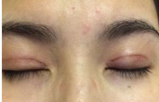 2024年臺州市頂尖整形醫(yī)院排行榜發(fā)布，震撼推薦臺州名列前茅的醫(yī)療機構(gòu)！