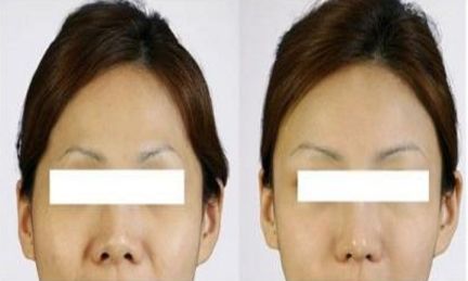 寧波美容整形診所評(píng)鑒及優(yōu)質(zhì)推薦