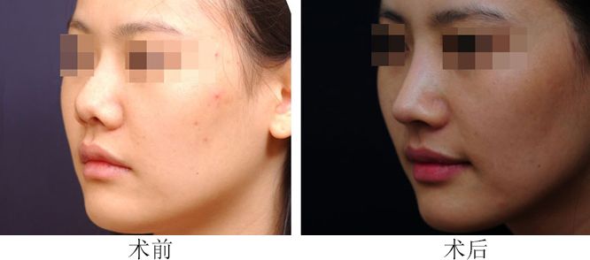 長春哪家整形醫(yī)院口碑年度最佳，排名比較好