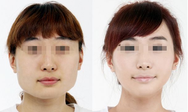 南京吸脂整形排名前十強(qiáng)醫(yī)院列表