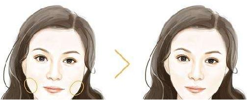 佛山生命加整形美容價格大揭秘，張春光元氣美狐眼等你了解