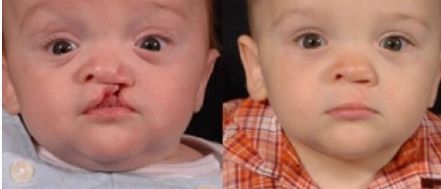 愛美人士必看！艾莉薇PK伊婉玻尿酸，功效、使用范圍、持久度對(duì)比