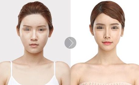 北京植發(fā)醫(yī)院推薦，哪家效果好？